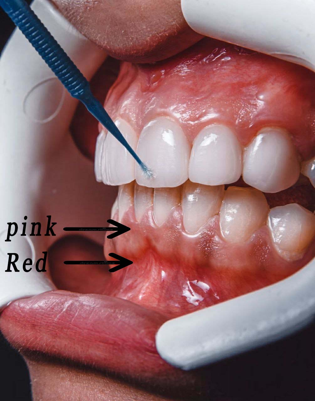 pink and red oral color